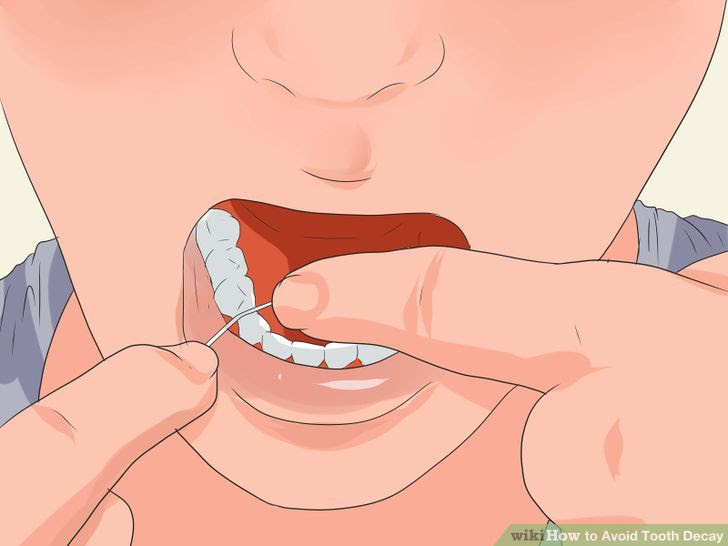 Avoid Tooth Decay Step 8.jpg