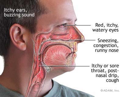 how to remedy maxillary sinus contamination