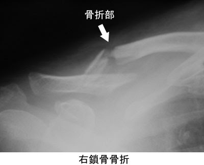 痛みの話q A 八王子整形外科 西八王子駅近くの整形外科専門クリニック