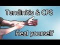 Carpal Tunnel Exercises