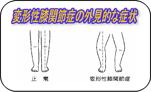 膝の痛み Home 菊池地域リハビリテーション広域支援センター 熊本リハビリテーション病院内 869 1106 熊本県菊池郡菊陽町曲手760 Tel 096 232 3194 Fax 096 232 3119 E Mail Chiiki Reha Marutakai Or Jp このホームページに掲載してある