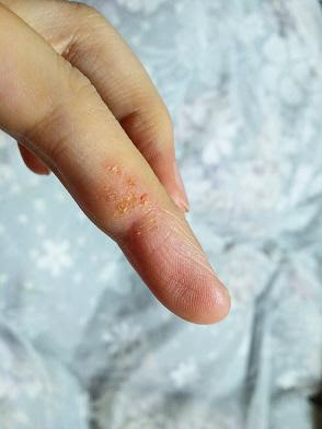 白魚のような手 なちゅらりぜ 楽天ブログ