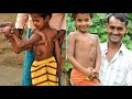 Extra Body Parts || People Born With Extra Body Parts in urdu Hidi