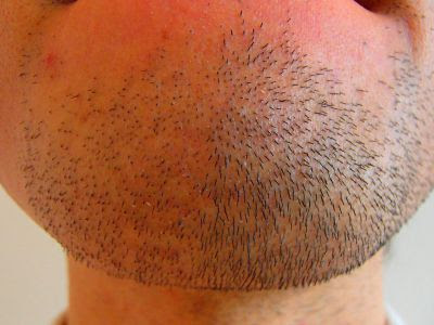 加古川 明石でヒゲ脱毛をお考えの方はcocolea Homme姫路へ