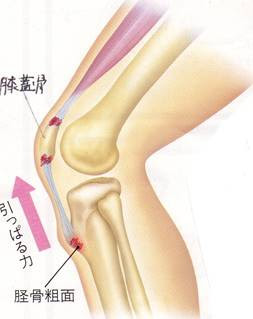 吉田整形外科 整形外科疾患の紹介