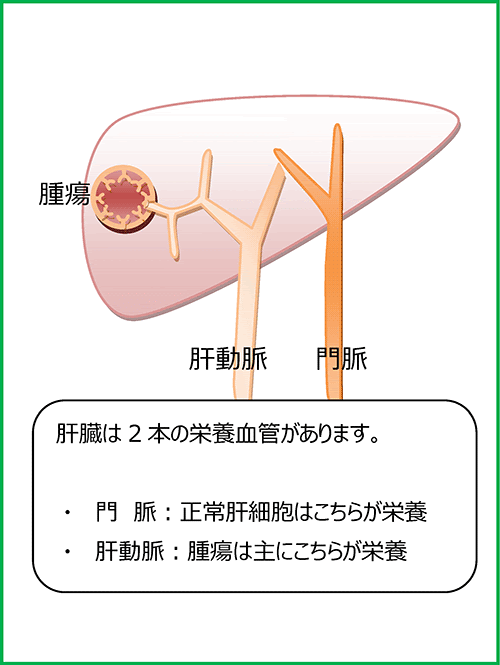 各種がんの解説 肝臓がん がん診療について 日本赤十字社 伊勢赤十字病院