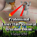 Laser Hair Removal Cost - Scar Removal - Kellis Eye & Laser CenterLaser Hair Removal Cost : 5 tips to the best permanent hair removal - DepSkin