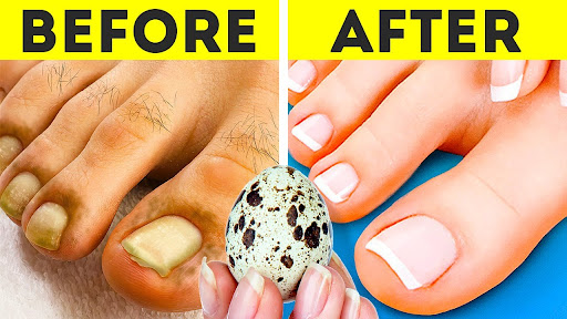 Amazing feet and shoes hacks you should know about!