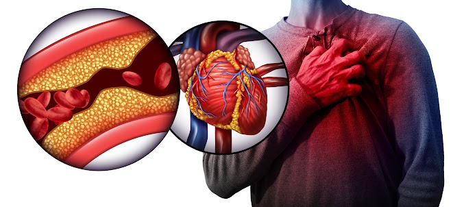 What is heart attack disease and how to treat it?