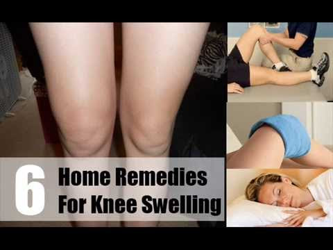 6 Home Remedies For Knee Swelling 
