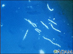 borrelia burgdorferi