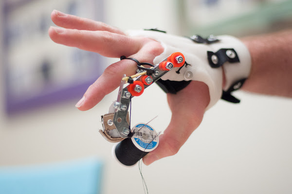 Prosthetic Fingers
