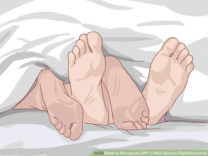 Recognize HPV in Men (Human Papillomavirus) Step 1 Version 2.jpg