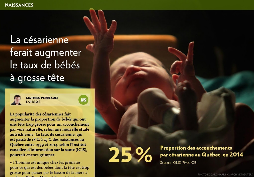 Plus De Grosses Tetes A Cause Des Cesariennes La Presse