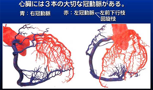 滋賀脳卒中 循環器病登録研究
