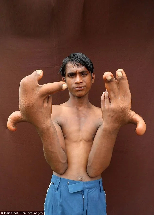 Tarik's hands measure 30cm long. Photo: Rare Shot/Barcroft Images