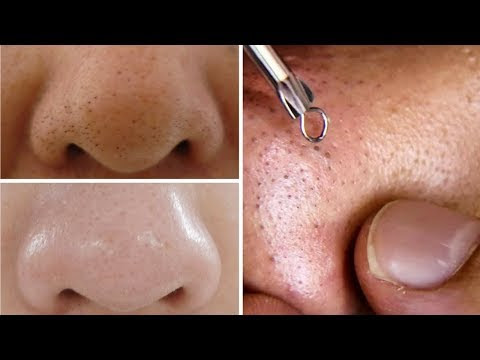 how to get clean face