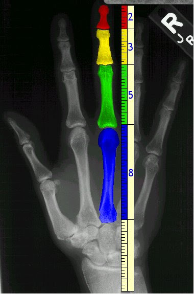 fibonacci