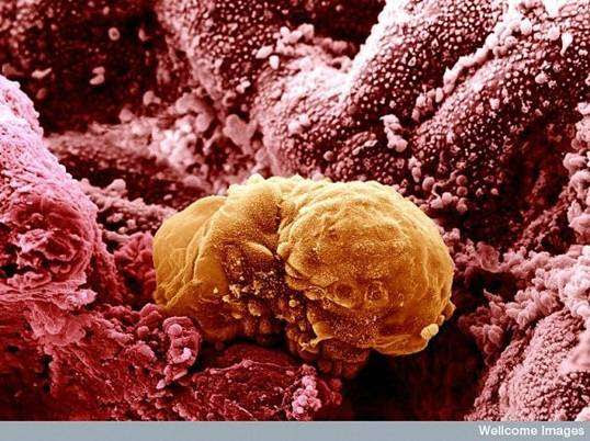 Gap Junctions In Cells. areas are gap junctions,