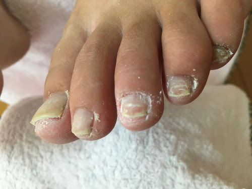 フット爪カット 甘皮処理 鹿児島 出水市 Nail Salon School 爪屋