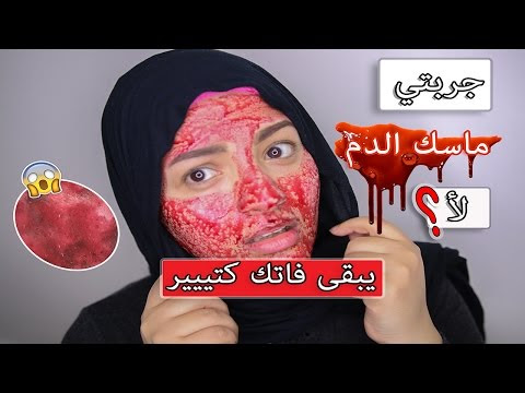 صورة