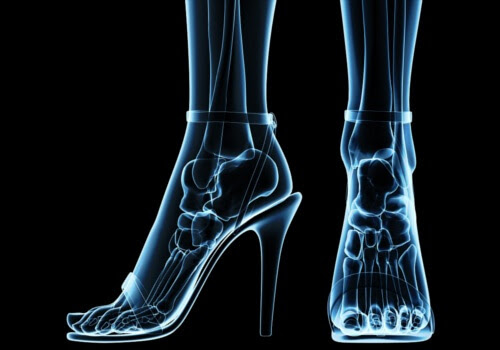 ALT TITLE shoes3