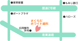セラミックインレー 奥歯の白い詰め物 銀歯のやり変え 福山市 さくらだホワイト歯科