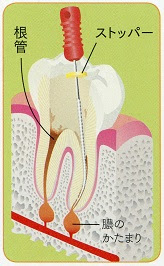 診療案内 Yamazaki Dental Clinic