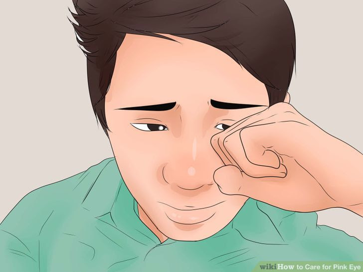 Care for Pink Eye Step 1 Version 2.jpg