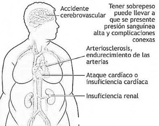 Enfermedades Del Sobrepeso Dibujo De Los Riesgos De La Obesidad Para Pintar Y Colorear Problemas Del Exeso De Peso En Masa Corporal Para Pintar Y Colorear Colorear Dibujos De Cholo