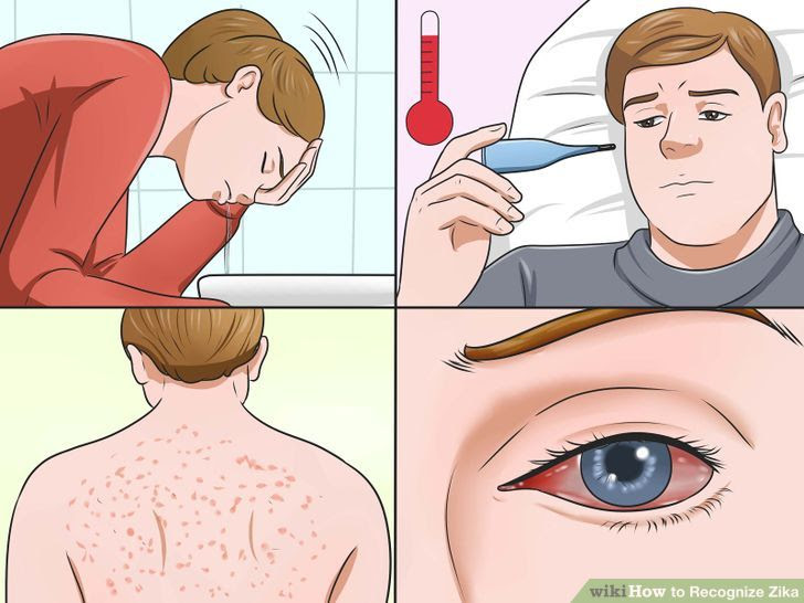 Recognize Zika Step 1.jpg
