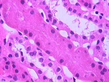 Proximal Convoluted Tubule. in the proximal convoluted