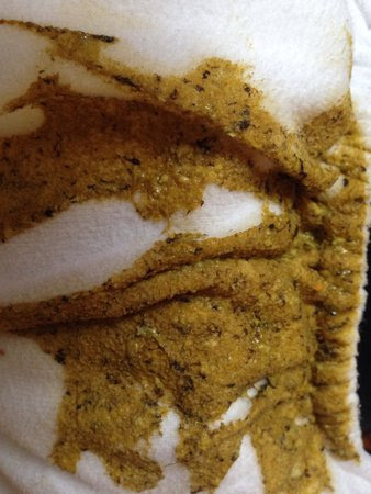 Black Specks In Poop Warning Pic Included Babycenter