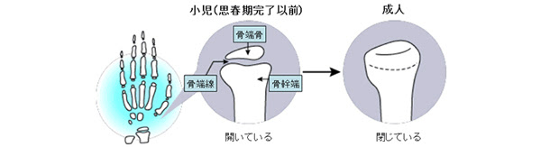 たかはしクリニック 神戸市灘区 診療内容 成長ホルモン分泌不全性低身長