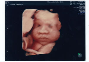 3d 4dエコー 高輪台レディースクリニック 港区の産科 婦人科