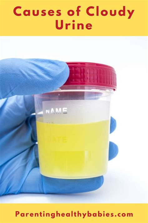  early pregnancy urine color images dolly swartz