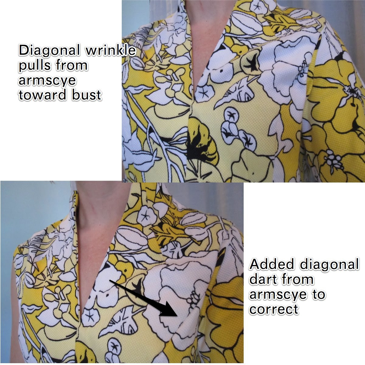 Added Armscye Dart