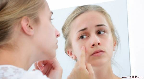 3 món ăn tuyệt đối tránh khi bị dị ứng da mặt