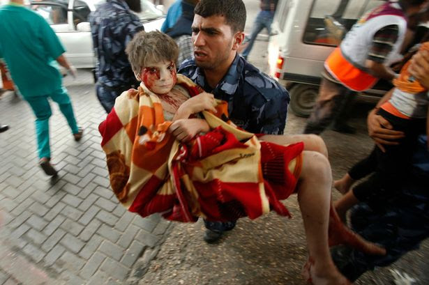 A boy, who was wounded in Israeli shelling, at a hospital in Gaza