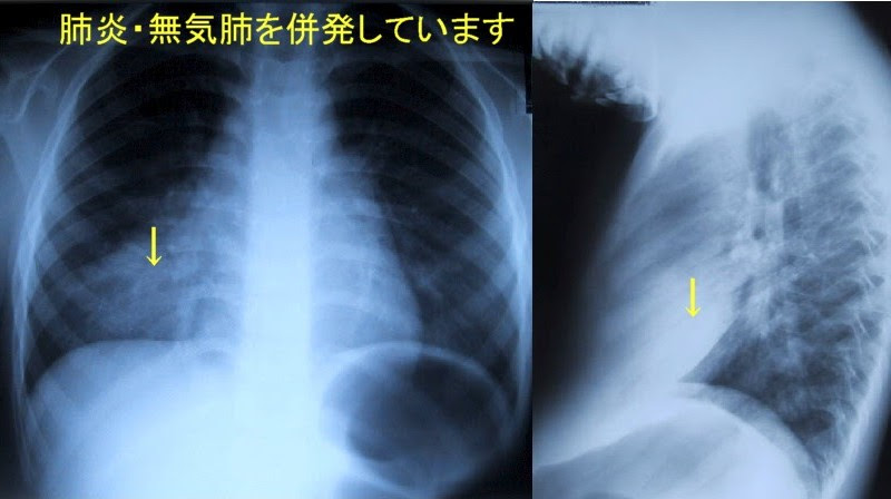 大分健生病院 小児科だより