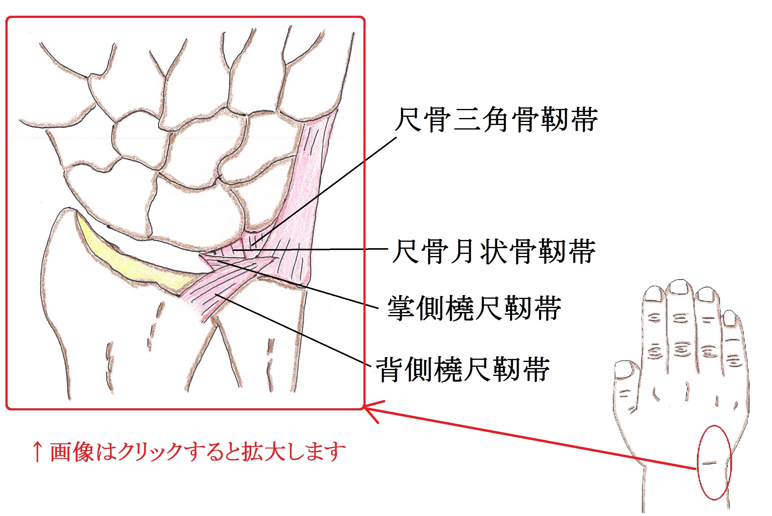 Tfcc 三角線維軟骨複合体 損傷 アスリートゴリラ鍼灸接骨院 旧高林はりきゅう接骨院