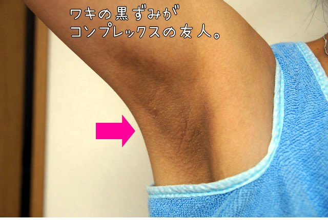 リーガン 毒液 九時四十五分 脇 黒ずみ 脱毛 Alians En Net