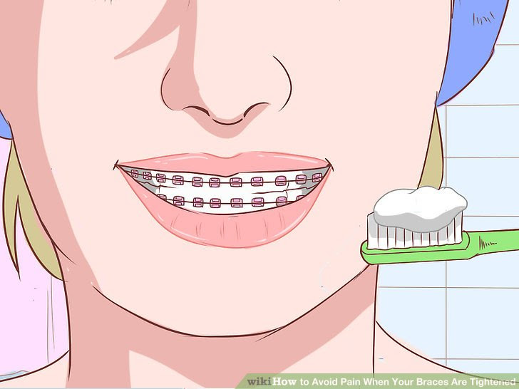 Avoid Pain When Your Braces Are Tightened Step 12 Version 2.jpg