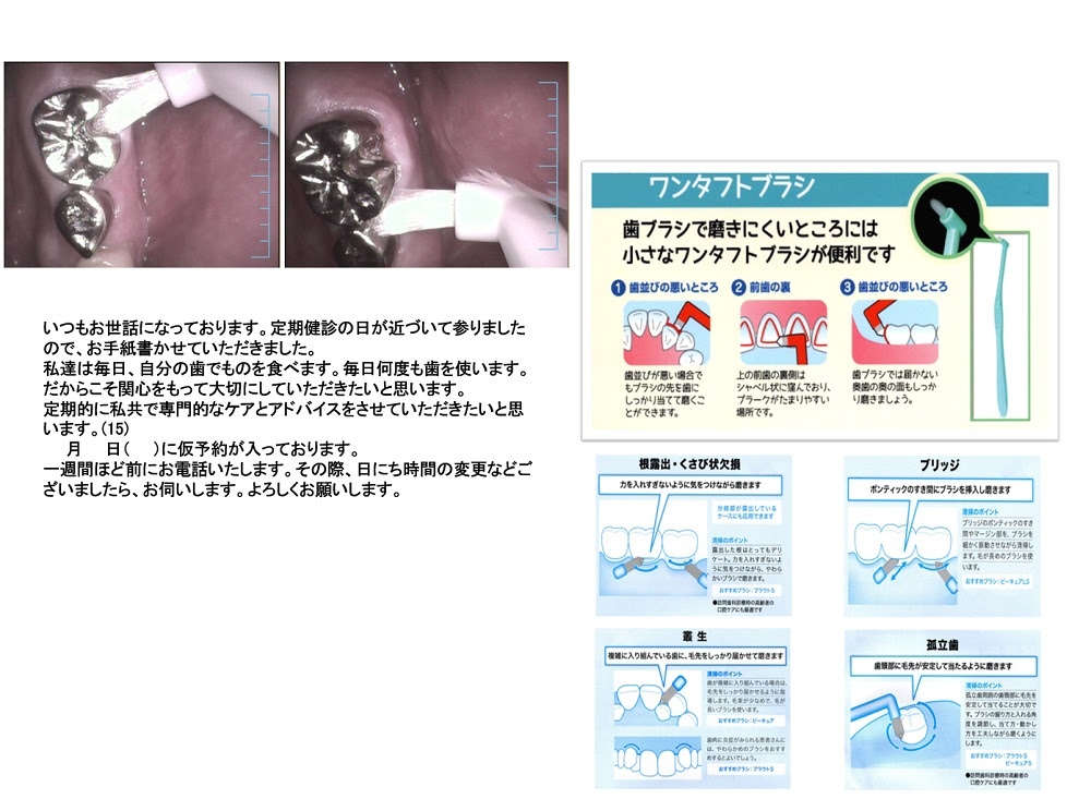 患者さんへの手紙 いとう歯科