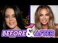 Khloe Kardashian Before : Khloe Kardashian Before and After Plastic Surgery Butt ... - Khloe kardashian has undergone a huge transformation throughout her career from being a kuwtk star to her revenge body tv show, but what did she look like before fame?