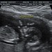 BURT_ADRIENNE_7