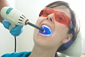 Advice And Strategies For Tooth whitening Tooth