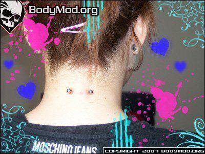 The nape of the neck