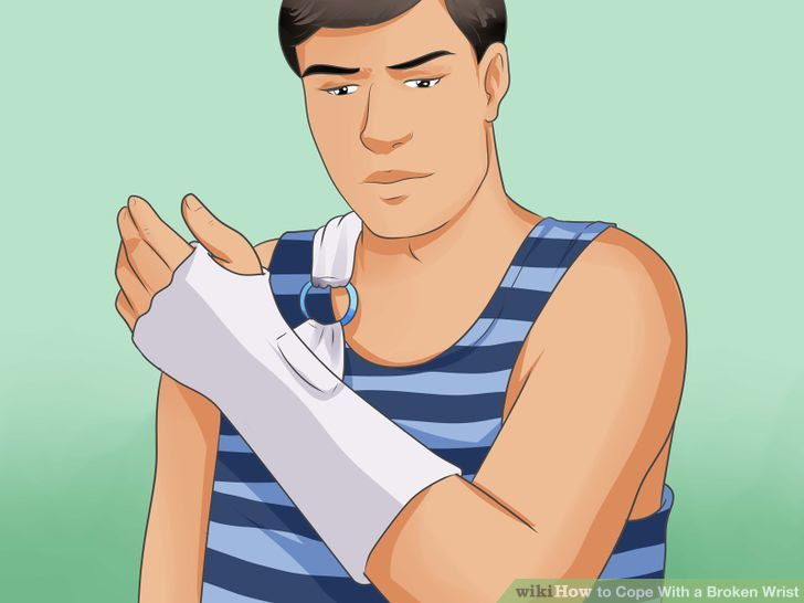 Cope With a Broken Wrist Step 5 Version 2.jpg