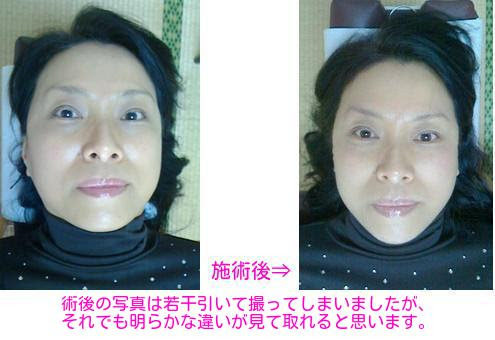 大阪 顔の歪み矯正と保証付き小顔矯正で口コミ人気no 1 天地カイロプラクティック